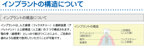 インプラント構造について