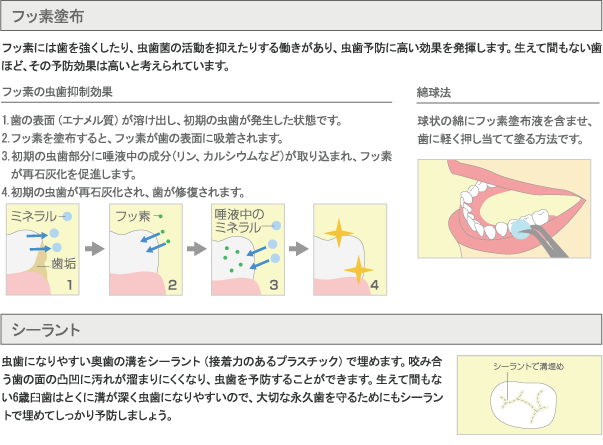 フッ素塗布・シーラント