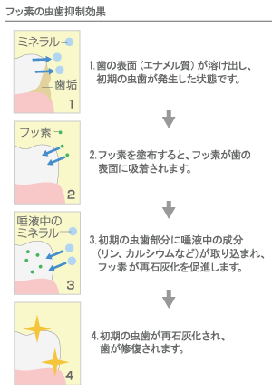 伊勢崎市の歯医者、ちぎら歯科の一般歯科、小児歯科、歯科口腔